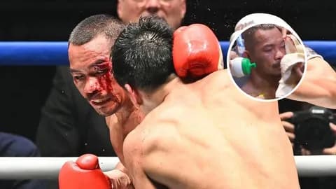 “นักมวยสากลไทย” พลาดมีแผลแตก กรรมยุติการชกยก 8 เสียแชมป์โลกอีกราย (คลิป)