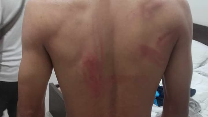 นักมวยไทยชื่อดัง แฉ! ปืนจ่อหัว-รุมกระทืบ บังคับให้สารภาพล้มมวยเวทีดัง